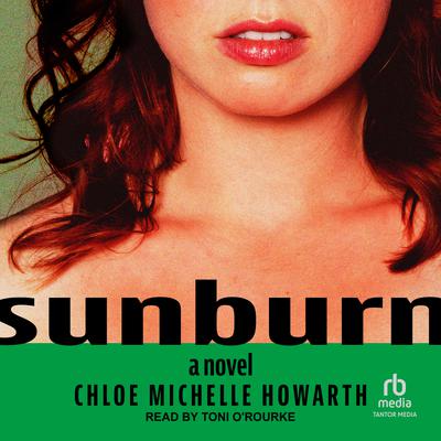 Sunburn